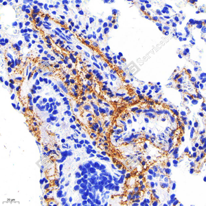 09 GB115707_Collagen I_C1758_C175822012502_d1000_R lung_40.0x_IHC_WM.png