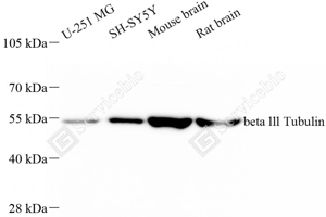 01 ZB15139-HRP_beta III Tubulin_d2000_WB_WM.png