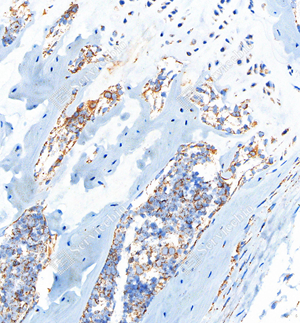 02 GB112328_Osteopontin_C037_C03720061002_d1000_M bone_30.0x_IHC_WM.jpg