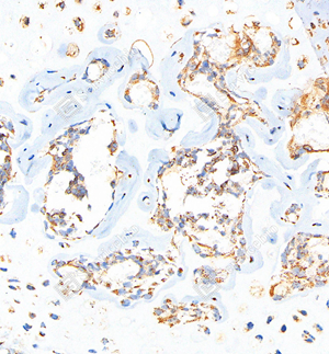 03 GB112328_Osteopontin_C037_C03720061002_d1000_M bone_36.5x_IHC_WM.jpg