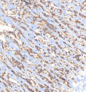 04 GB112328_Osteopontin_C037_C03720061002_d1000_R bone_22.4x_IHC_WM.jpg