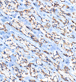 05 GB112328_Osteopontin_C037_C03720061002_d1000_R bone_25.6x_IHC_WM.jpg