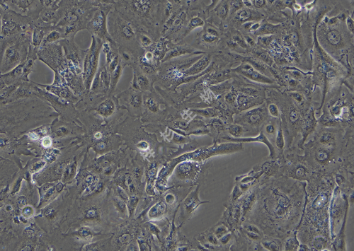 ACHN-LUC-GFP-白光.png