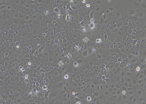 Ca ski-LUC-GFP-白光.png