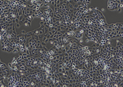 CAL-27-LUC-GFP-白光.png