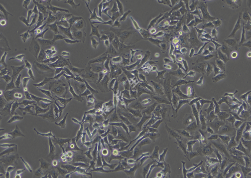 HELA-LUC-GFP-白光.png