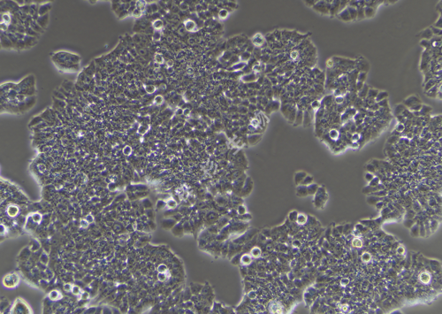 T-47D-LUC-GFP-白光.png
