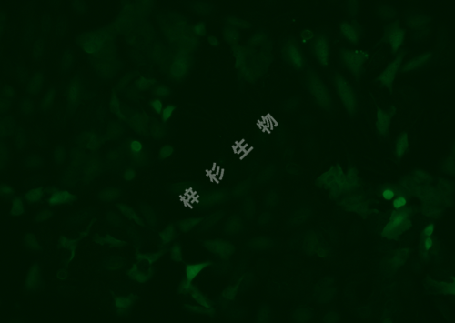 TPC-1-LUC-GFP-荧光.png