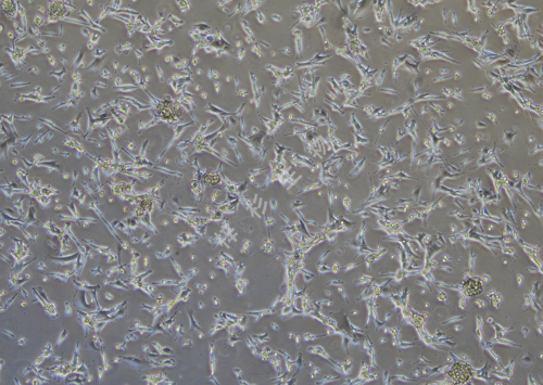 U87 MG-LUC-GFP-白光.png
