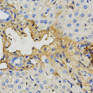 06  GB114491_20220525_Fibronectin_C1846_C184622042402 M fibrotic liver d1000_40x_IHC.png