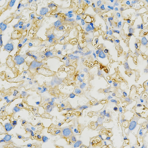 07  GB114491_20220525_Fibronectin_C1846_C184622042402 M placenta d1000_40x_IHC.png