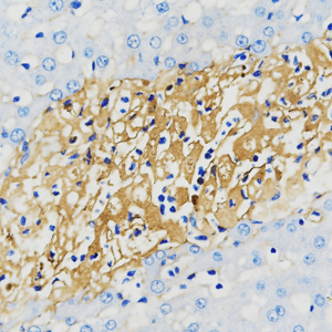 08  GB114491_20220525_Fibronectin_C1846_C184622042402 R fibrotic liver  d1000_40x_IHC.png