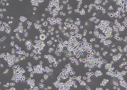 MKN-45-LUC-GFP-白光.png