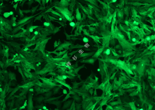 U251-LUC-GFP-荧光.png