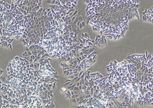 HCT-8-LUC-GFP-白光.jpg