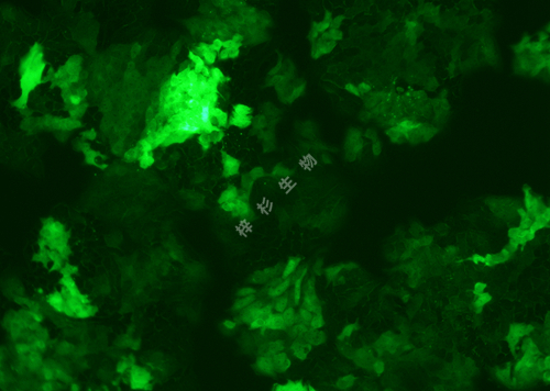 HCT-8-LUC-GFP-荧光.jpg