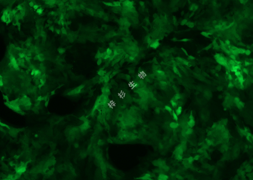 Detroit562-LUC-GFP-荧光.jpg