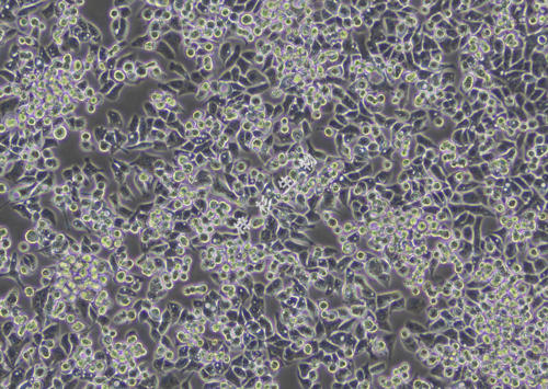 HEC-1-B-LUC-GFP-白光.jpg