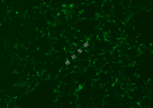 IMR-32-LUC-GFP-荧光.jpg