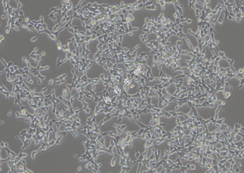 IMR-32-LUC-GFP-白光.jpg