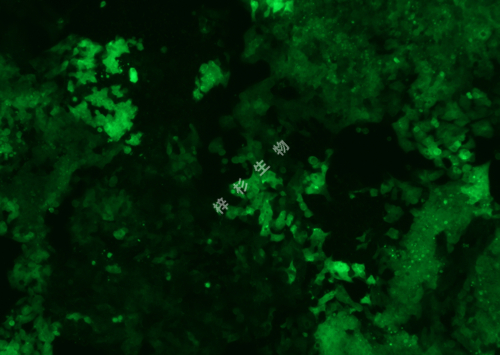 LOVO-LUC-GFP-荧光.jpg