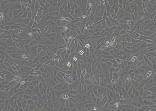 SAOS-2-LUC-GFP-白光.jpg
