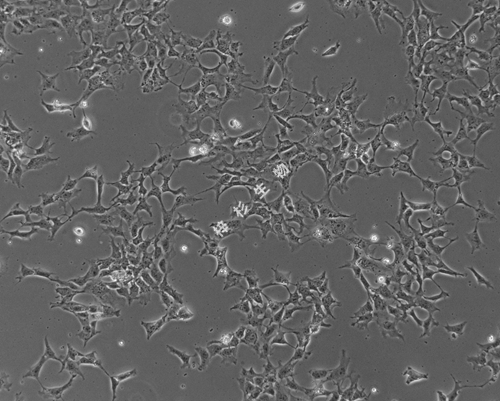低密度照片.jpg