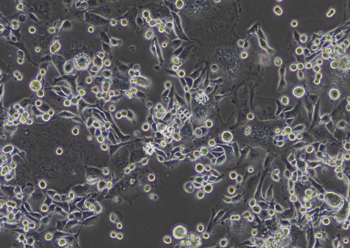 Anglne-LUC-GFP-白光.png