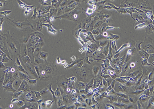 DU145-LUC-GFP-白光.png