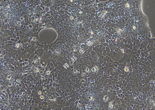 FaDu-LUC-GFP-白光.png