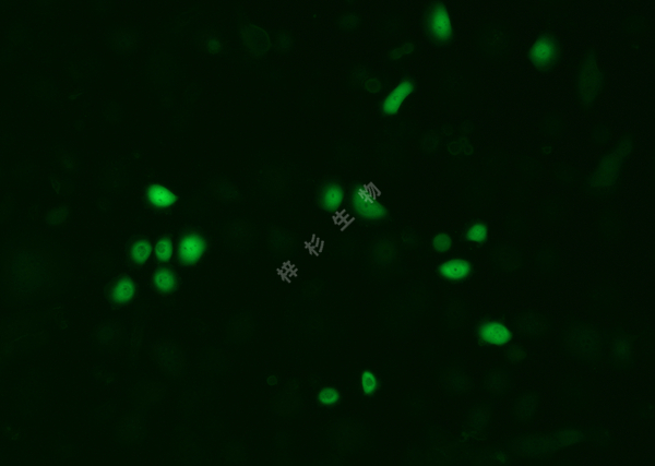 HCC1937-LUC-GFP-荧光.jpg