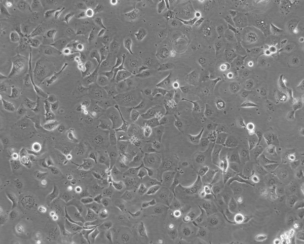 HCC1937-LUC-GFP-白光.jpg