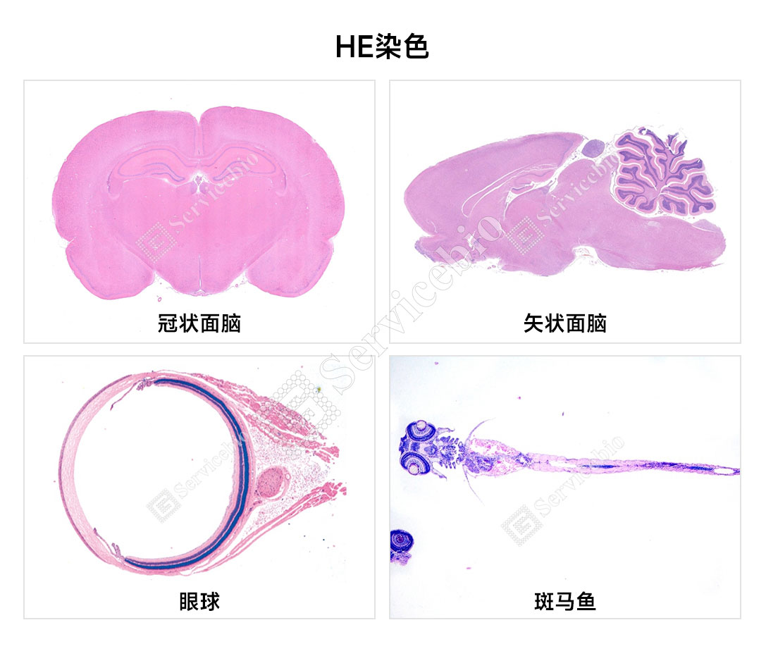 HE染色.jpg