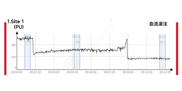 4、多普勒血流.jpg