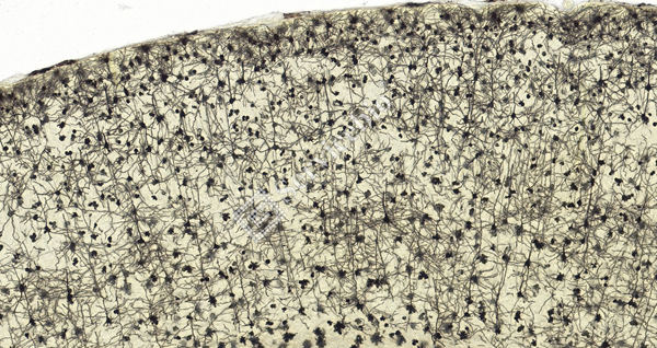 ① 大脑皮层  _10.0x.jpg