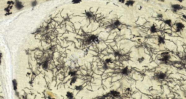 ④ 纹状体  _20.0x.jpg