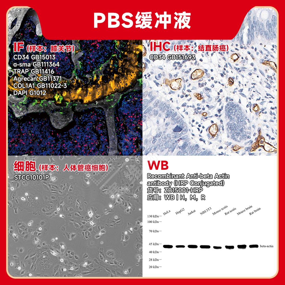 赛维尔生物服务|产品_Servicebio_武汉赛维尔生物科技有限公司