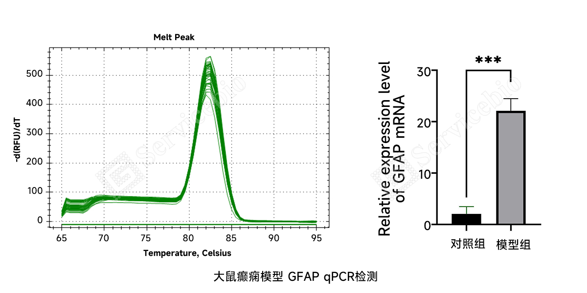 10.QPCR.jpg 10.QPCR.jpg