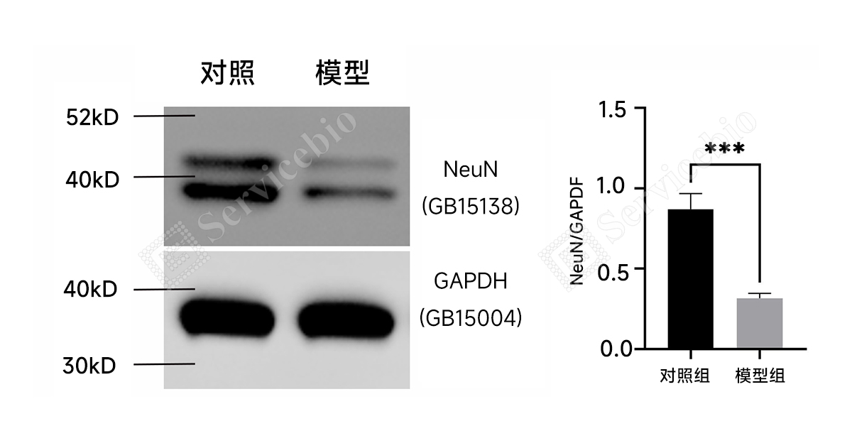 11、皮层WB-GFAP.jpg 11、皮层WB-GFAP.jpg