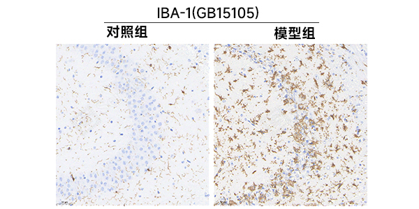 4、脑免疫组化（IBA-1）.jpg