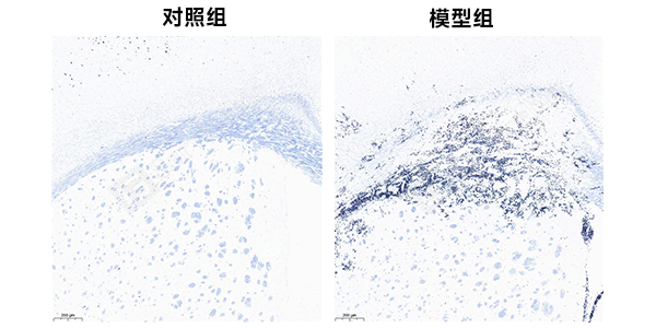 8、脑髓鞘改良LoyeZ染色.jpg