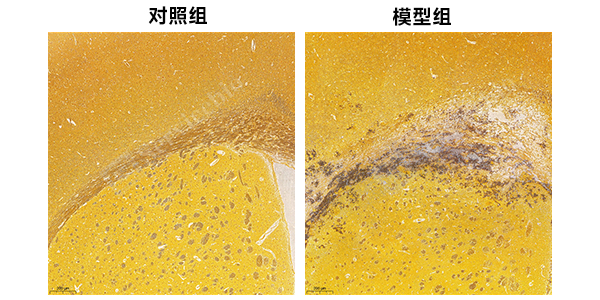9、氨酸银染色（镀银）染色.jpg