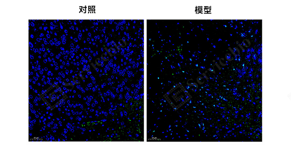 11、脑FJB染色.jpg