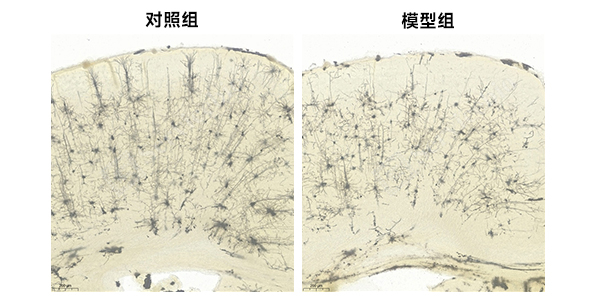 10、脑高尔基染色.jpg