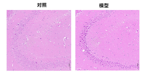 4、脑组织HE染色.jpg
