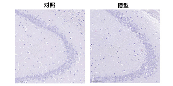 6、脑组织刚果红染色.jpg