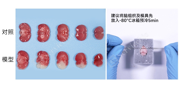 YA1036小鼠脑梗MCAO模型.jpg