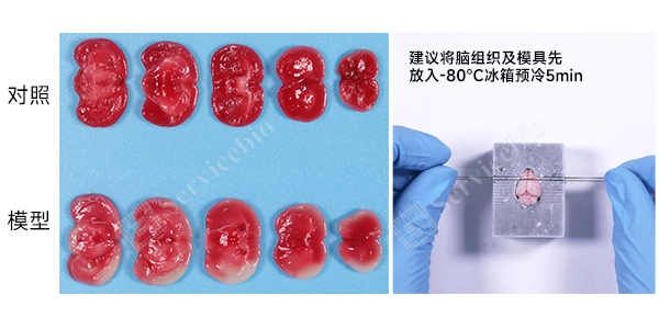 YA1129小鼠脑缺血再灌注模型.jpg