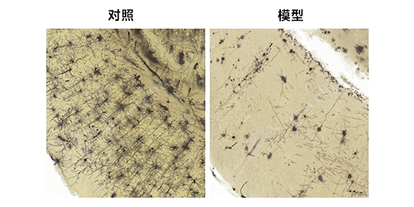 高尔基染色组图.jpg