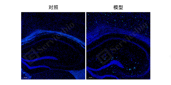 23-YA1288-小鼠阿尔茨海默症-脑组织硫磺素S染色（15月龄）.png